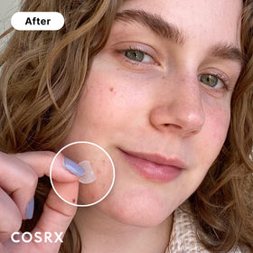 COSRX close-up of hydrocolloid patch texture highlighting gentle absorption benefit