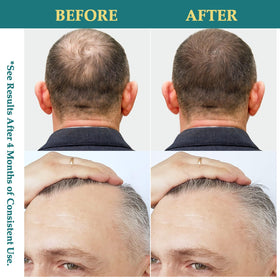 Creip texture of oil spray on skin showing lightweight, non-greasy absorption
