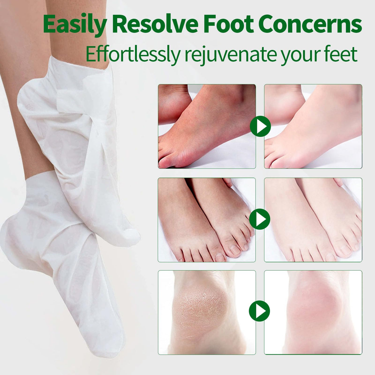 CRISTALBOX feet wearing masks and outer socks showing secure fit benefit