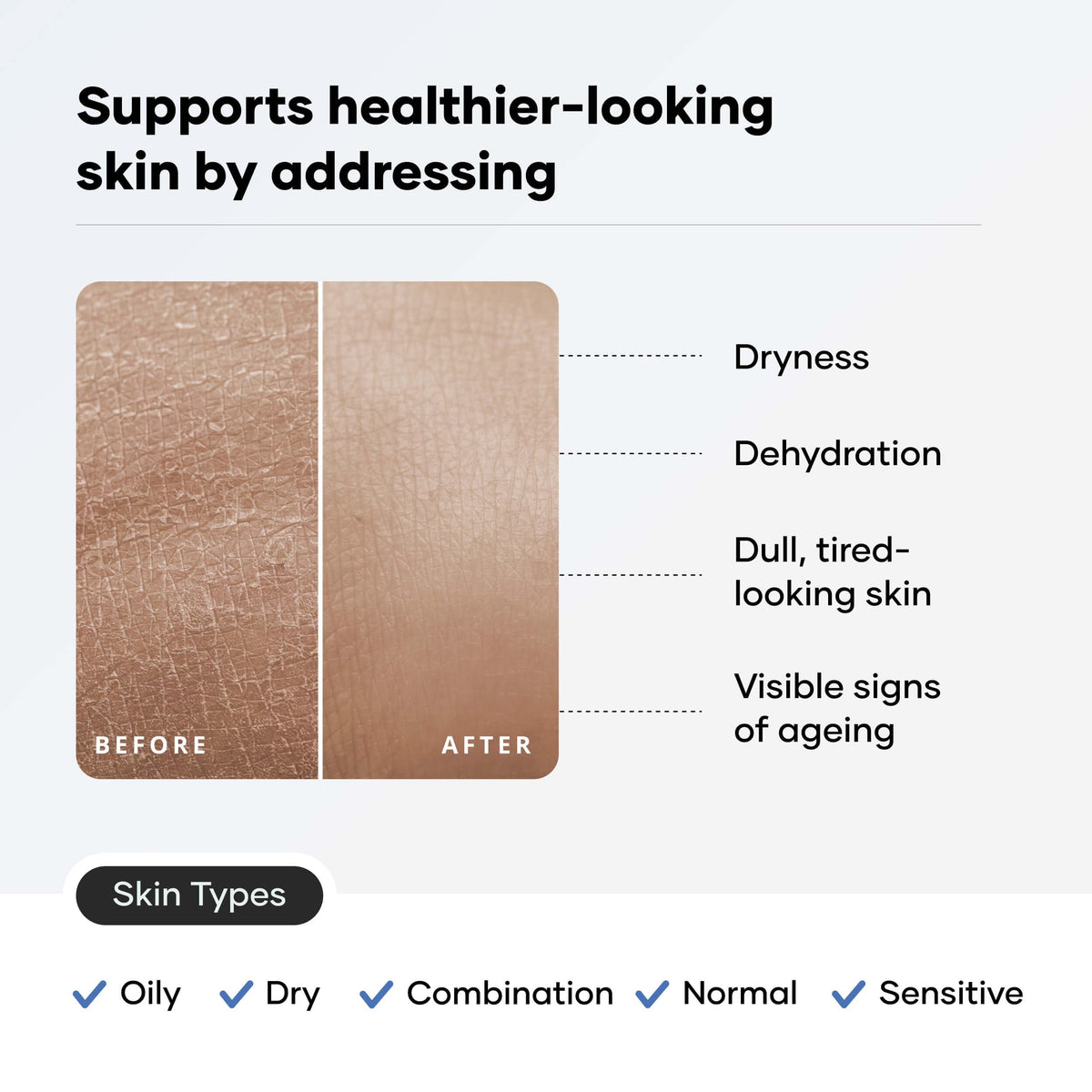 Cureskin back label ingredient panel highlighting ceramides