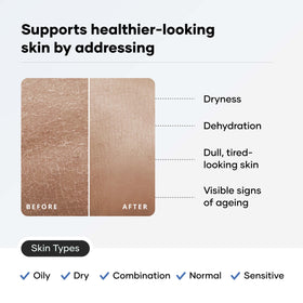 Cureskin back label ingredient panel highlighting ceramides
