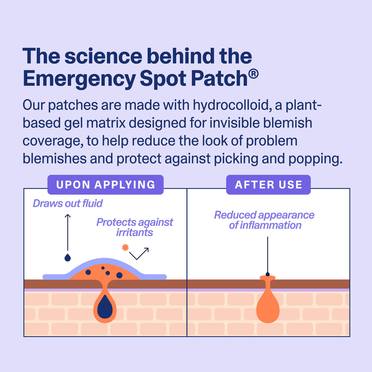 Curology patch under makeup showing discreet coverage and confidence benefit