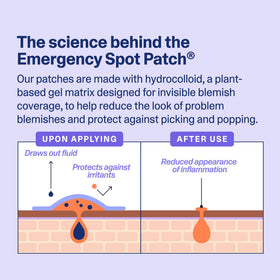 Curology patch under makeup showing discreet coverage and confidence benefit