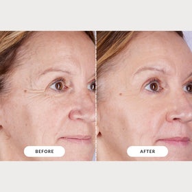 CurrentBody Series 2 size and scale comparison illustrating full-face coverage