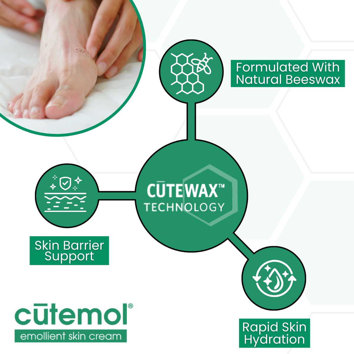 Cutemol used on heel showing improved skin texture and reduced cracking