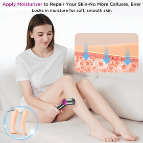 CYFERUY device in use on heel demonstrating effective callus removal