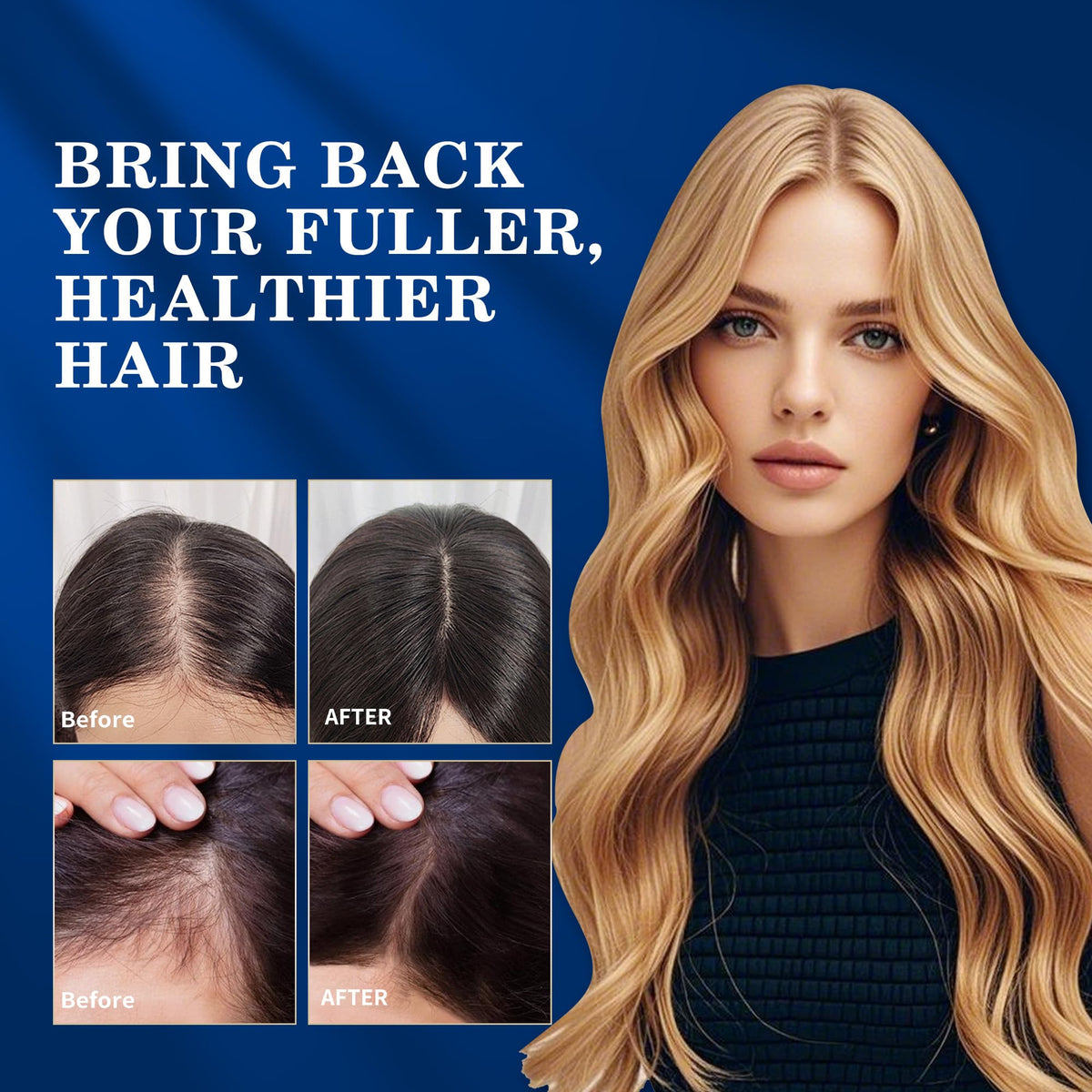 DAAZZS applied to thinning scalp area illustrating targeted regrowth use