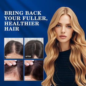 DAAZZS applied to thinning scalp area illustrating targeted regrowth use