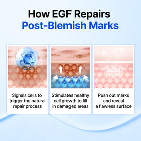 DearKlairs ingredient label detail showing EGF and FGF concentrations benefit