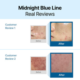 DearKlairs small dab on skin to show recommended serving size and non-greasy finish