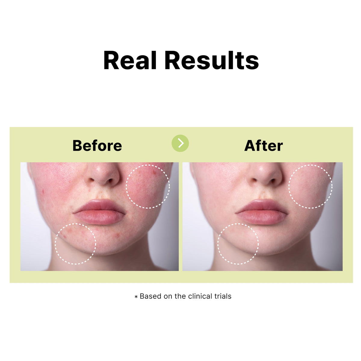 DearMYDEW ingredient label detail highlighting niacinamide and salicylic acid benefits