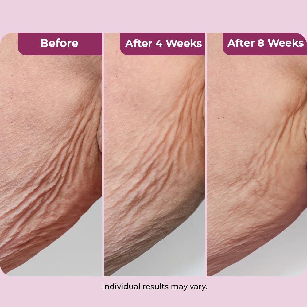 DEKLIDERM cream close-up emphasizing smooth texture and moisturizing benefit