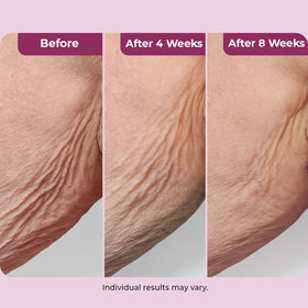DEKLIDERM cream close-up emphasizing smooth texture and moisturizing benefit
