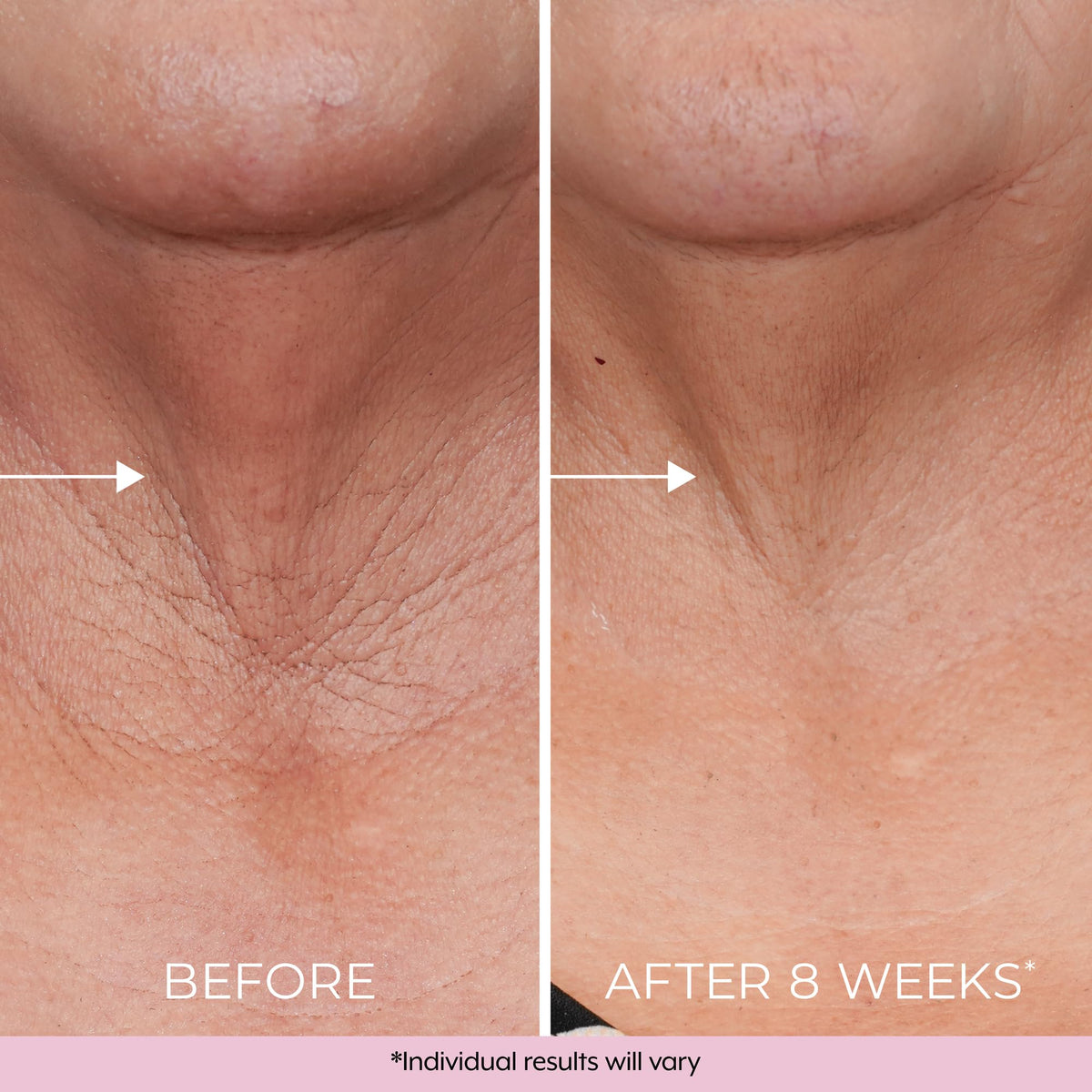 DEKLIDERM ingredients retinol and bakuchiol presented to highlight gentle efficacy