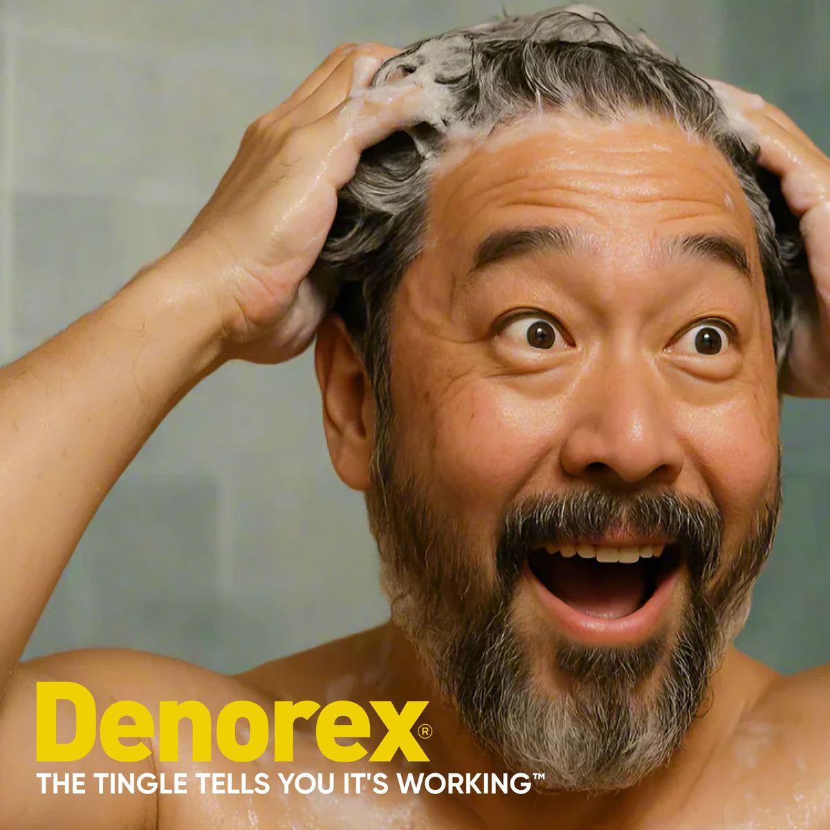 Denorex being applied to wet hair in hand for scalp treatment