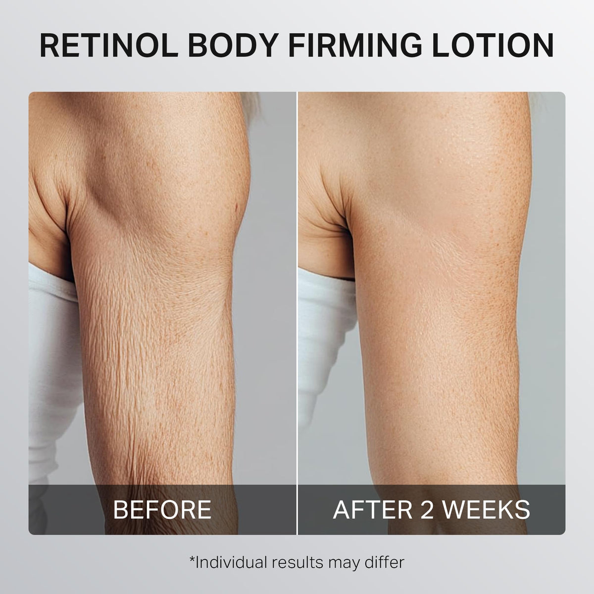 depology treated skin after application showing improved texture