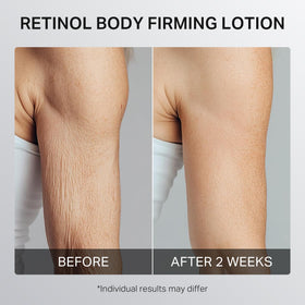 depology treated skin after application showing improved texture