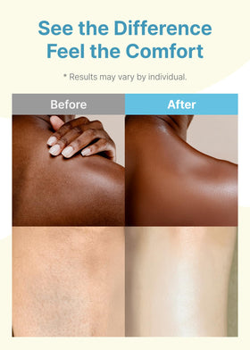 Derma B oil texture on hand illustrating quick absorption benefit
