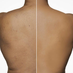 Dermablend being set with loose powder to lock in transfer-resistant wear