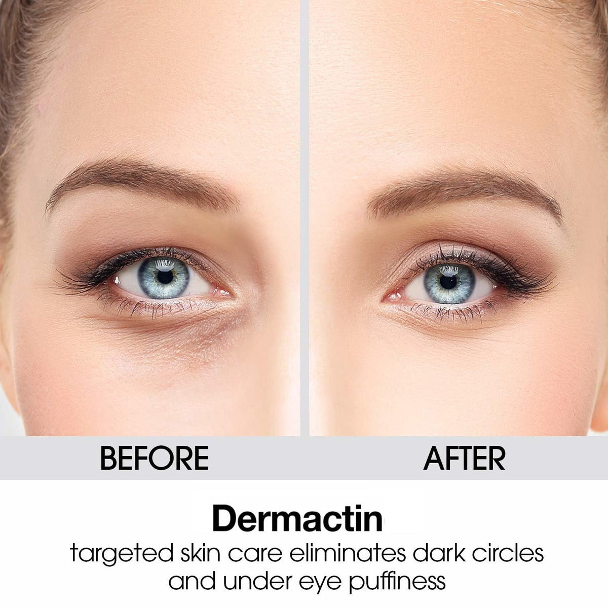 Dermactin before and after comparison showing reduced appearance of fine lines after use