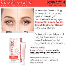Dermactin cream on fingertip ready for precise upper eyelid use