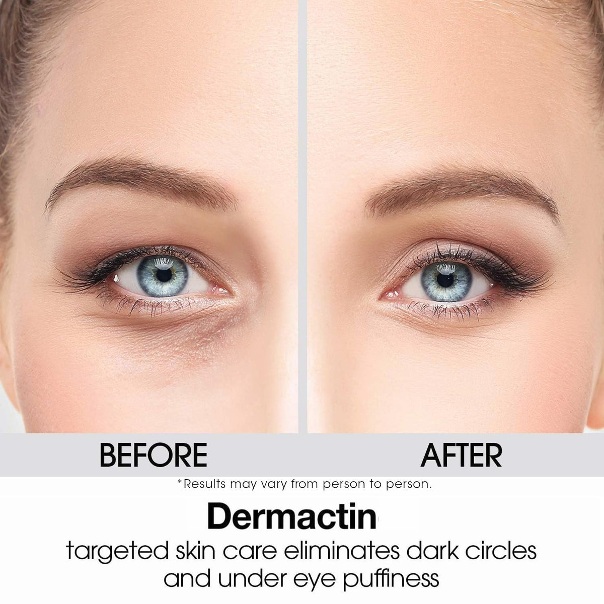 Dermactin applied to upper eyelid showing targeted coverage benefit