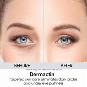 Dermactin applied to upper eyelid showing targeted coverage benefit