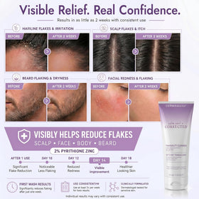 DERMAdoctor milky cleanser texture close-up demonstrating gentle foam