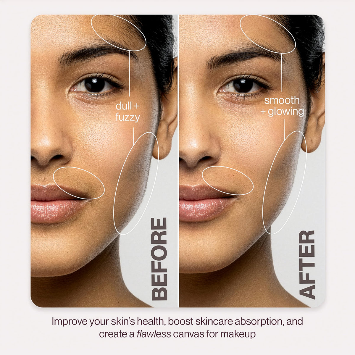 DERMAFLASH microfine edge blade close-up showing precision edge for safe exfoliation and hygiene