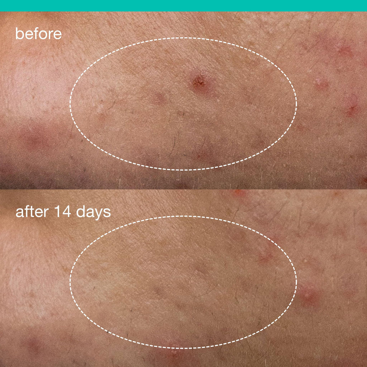 Dermalogica thin invisible film set on skin close-up, breathable barrier benefit