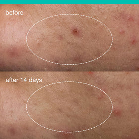 Dermalogica thin invisible film set on skin close-up, breathable barrier benefit