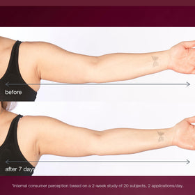 Dermalogica application on arm demonstrating targeted firming and smoothing