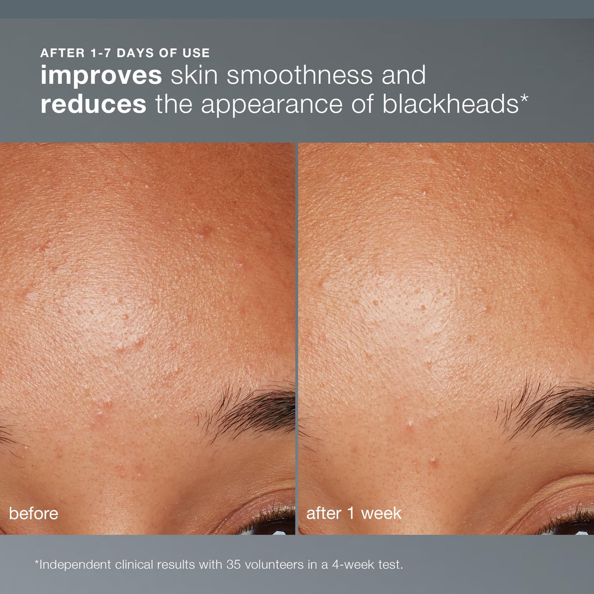 Dermalogica jar open with visible powder, convenient refill and long shelf benefit
