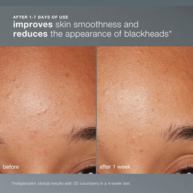 Dermalogica jar open with visible powder, convenient refill and long shelf benefit