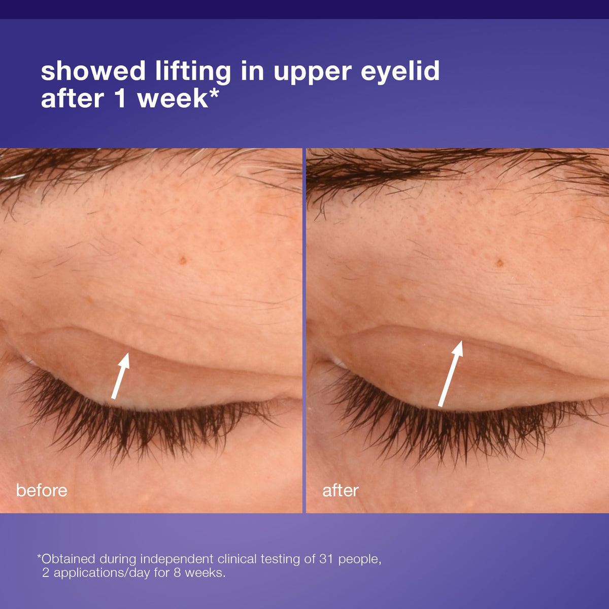 Dermalogica applying cream under eye demonstrating gentle use benefit