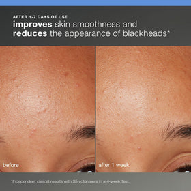 Dermalogica Skin Smoothing Cream squeezed from tube showing lightweight hydration