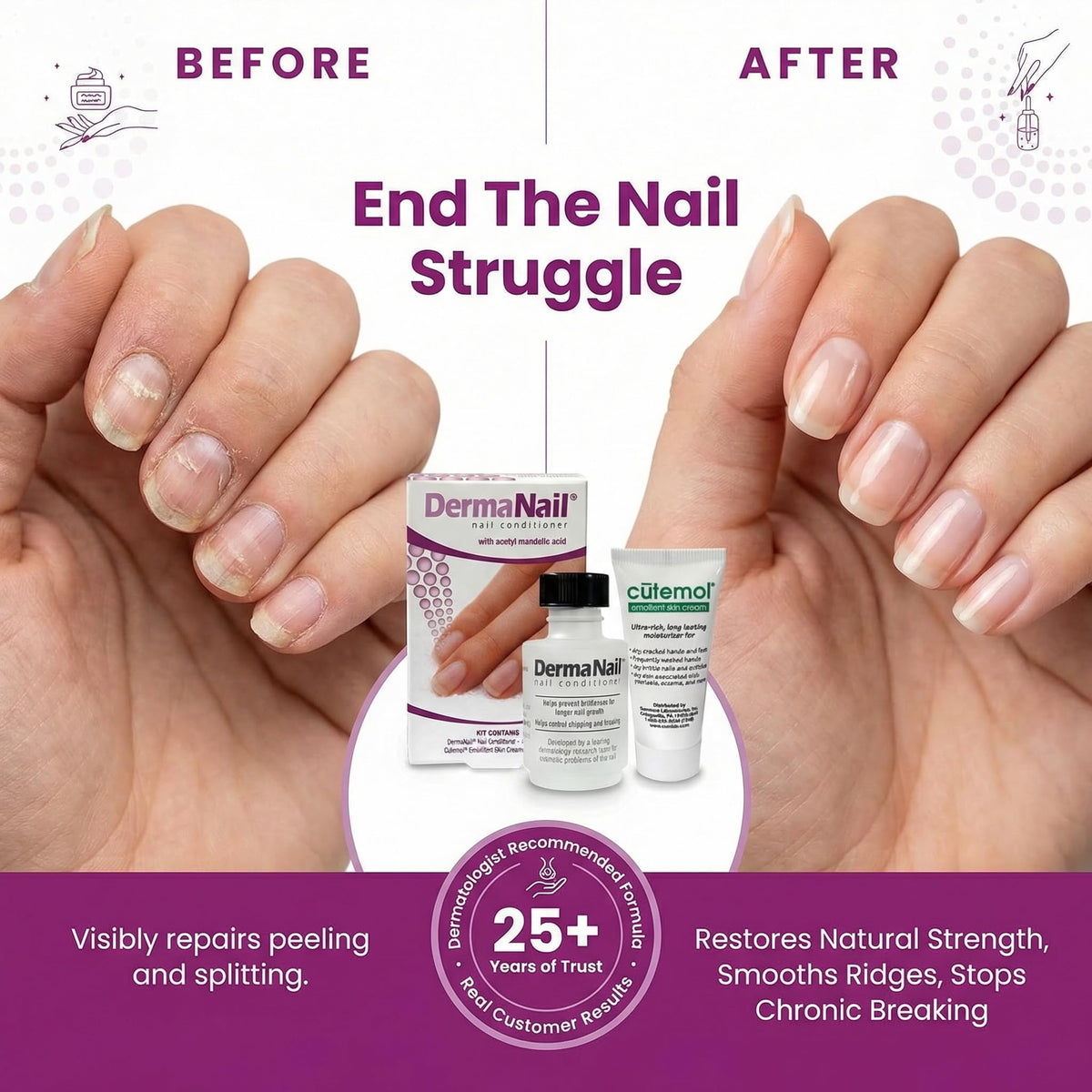 DermaNail Cutemol 11.5g sample tube displayed to moisturize cuticles