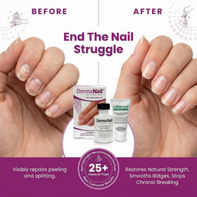 DermaNail Cutemol 11.5g sample tube displayed to moisturize cuticles