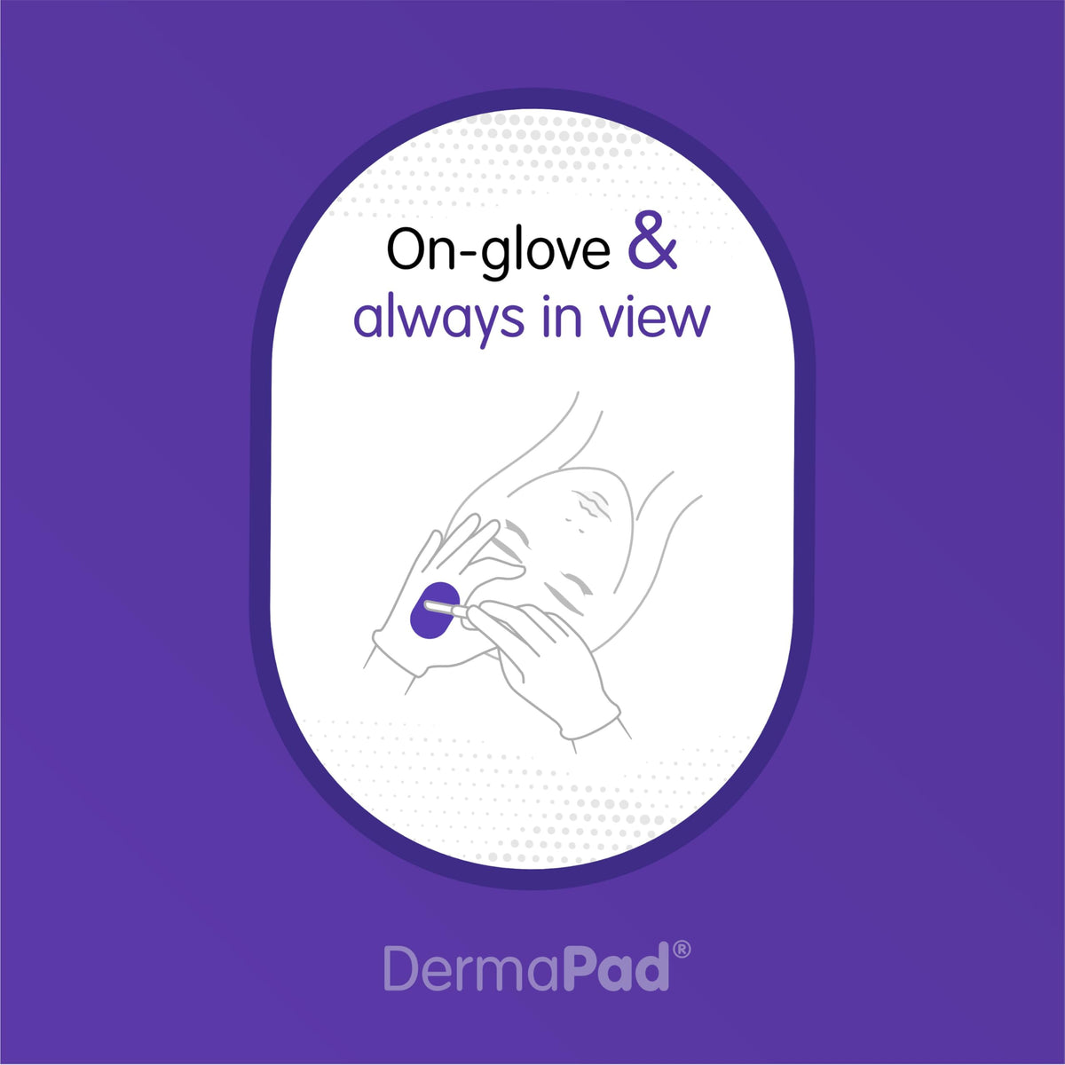 Dermapad scale and size comparison showing brand and glove fit clarity