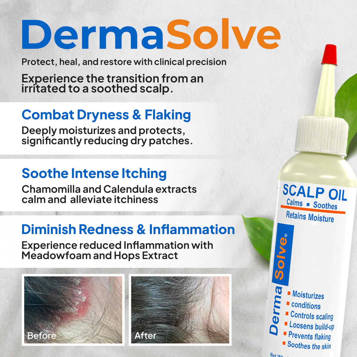 Dermasolve close-up dropper dispensing oil, precise application benefit
