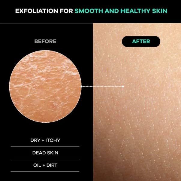 Dermasuri in-shower use demonstrating back coverage and thorough cleansing