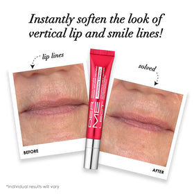 Dermelect ceramic applicator close-up for precise upper lip treatment and less waste