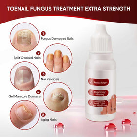 DERMFREE in-use on toes demonstrating improved look and everyday confidence