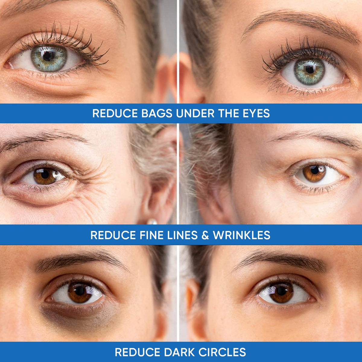 Dermlogic application tube and nozzle for precise under-eye targeting