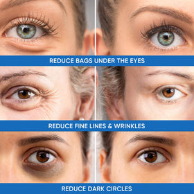 Dermlogic application tube and nozzle for precise under-eye targeting
