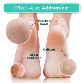 DERMORA application step-by-step showing easy one-hour home treatment