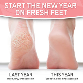 Person wearing Dermora foot mask booties to relax during treatment