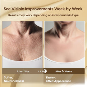 DERPHEA application on neck demonstrating smoother feel benefit
