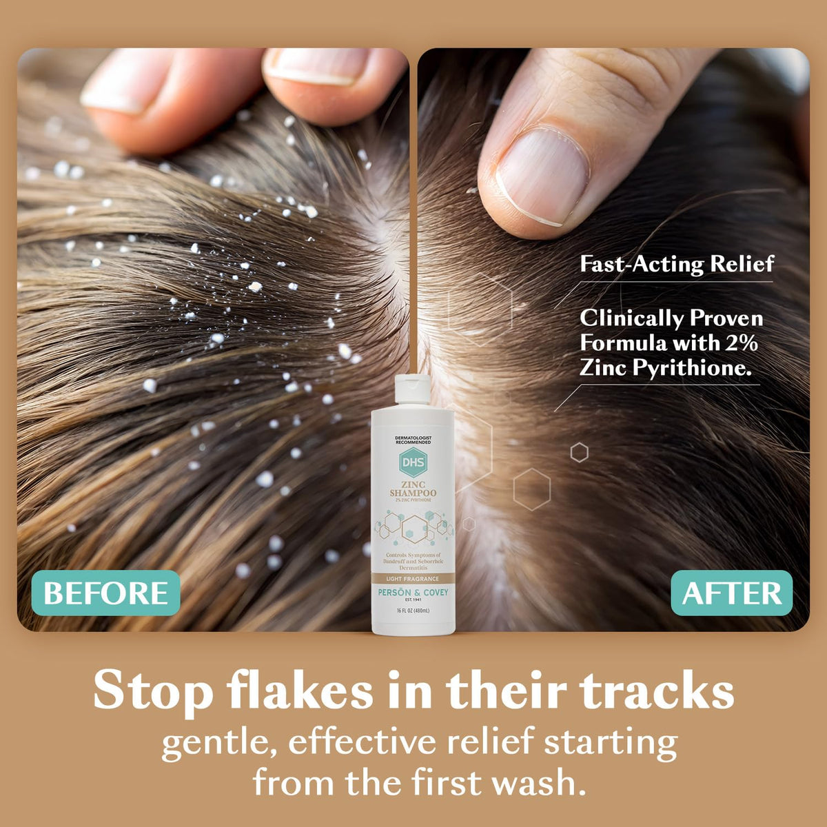 DHS creamy lather close-up illustrating gentle clean and scalp comfort