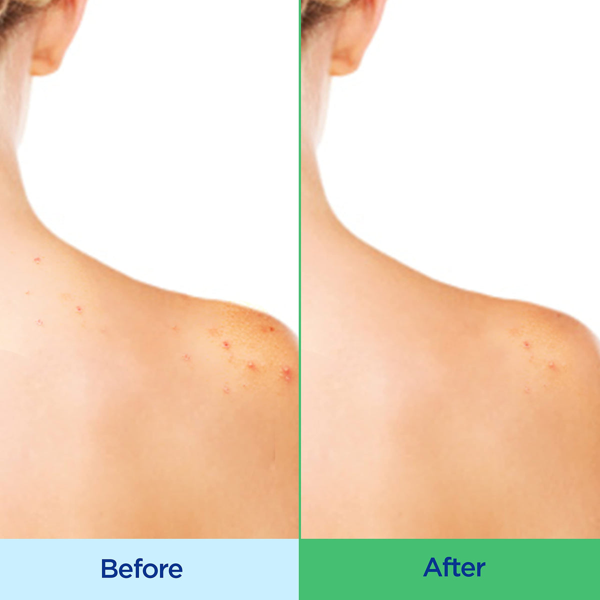 Differin label close-up highlighting 2% salicylic acid and hydrating ingredients, informs users